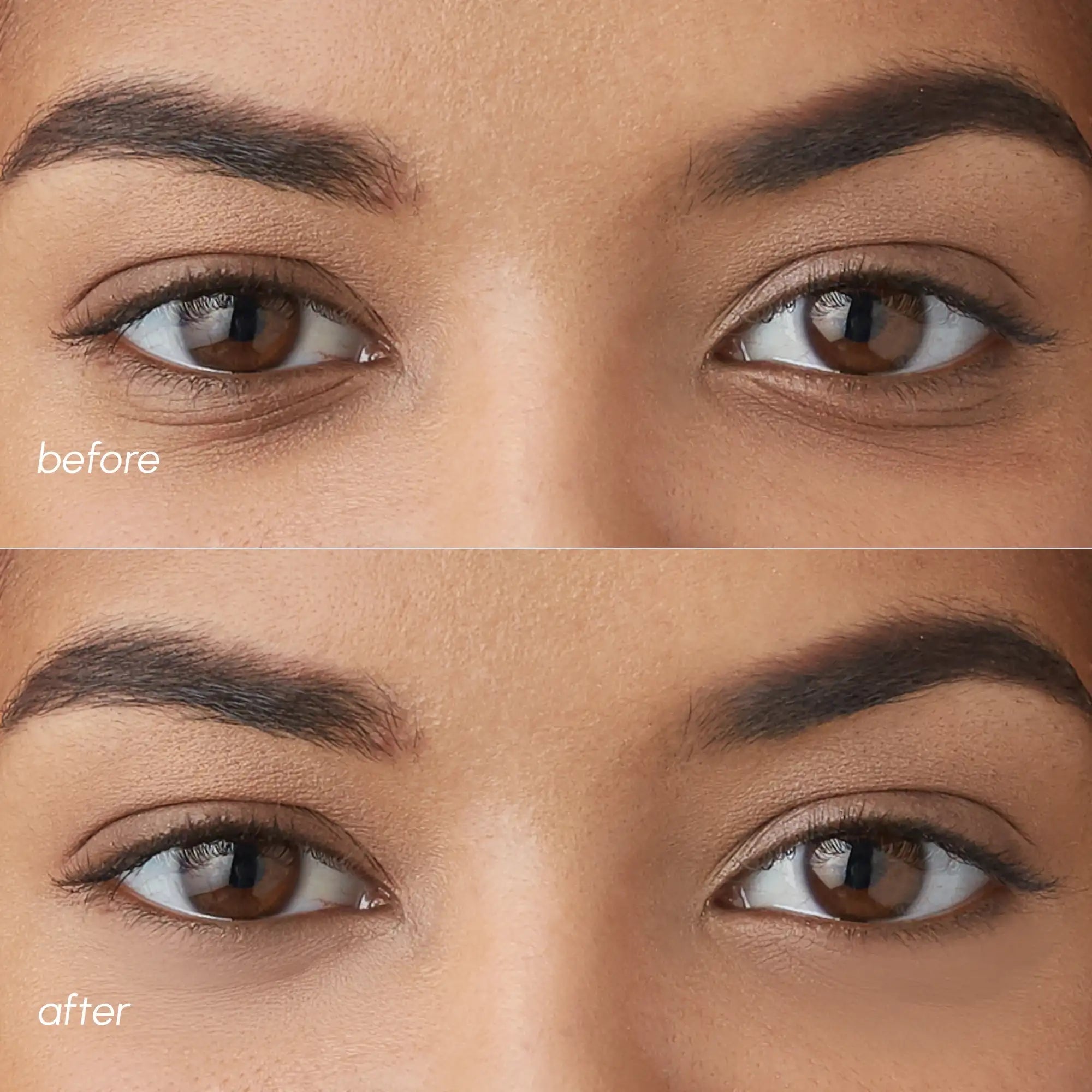 Violet Eye Patches for Dark Circles